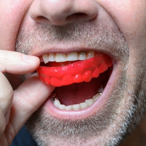 Close up of man placing red mouthguard into his mouth
