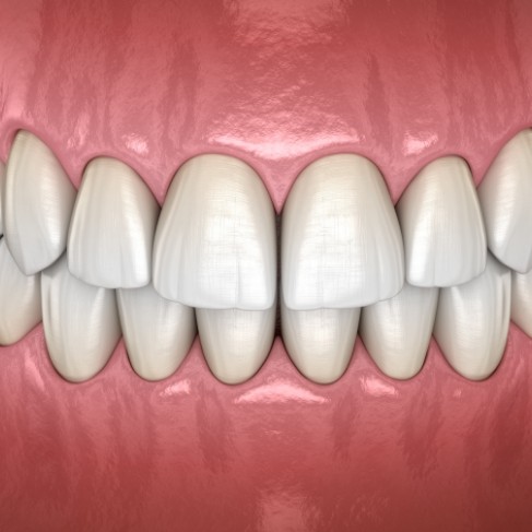 Illustrated mouth with straight white teeth